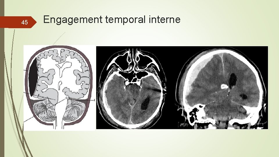 45 Engagement temporal interne 45 Engagement temporal interne