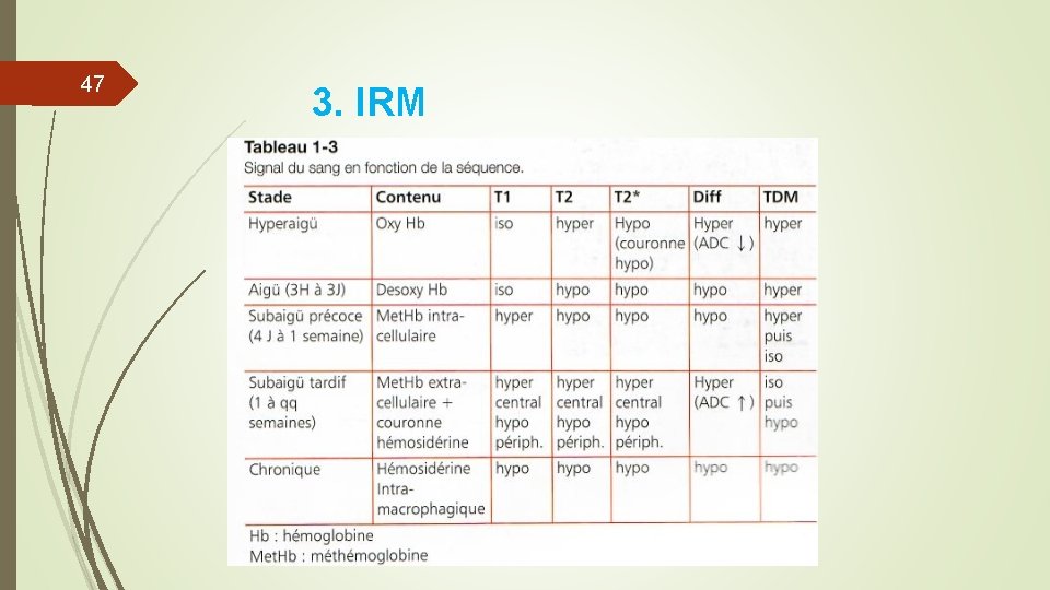 47 3. IRM 47 3. IRM