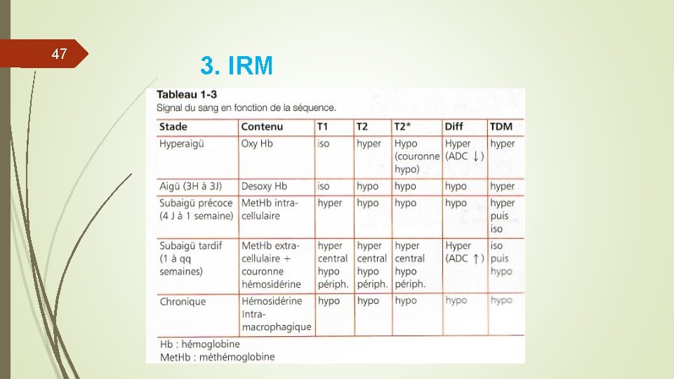 47 3. IRM 