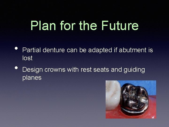 Plan for the Future • • Partial denture can be adapted if abutment is