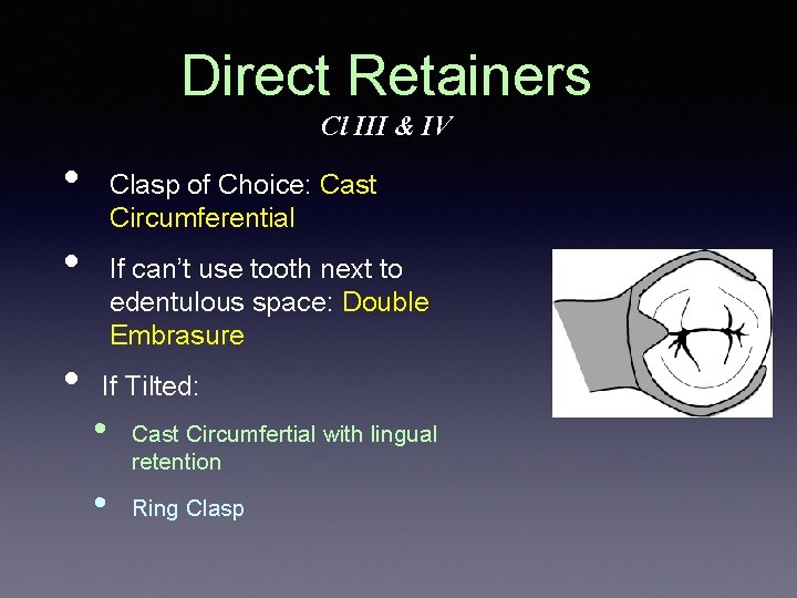 Direct Retainers Cl III & IV • Clasp of Choice: Cast Circumferential • • Direct Retainers Cl III & IV • Clasp of Choice: Cast Circumferential • •