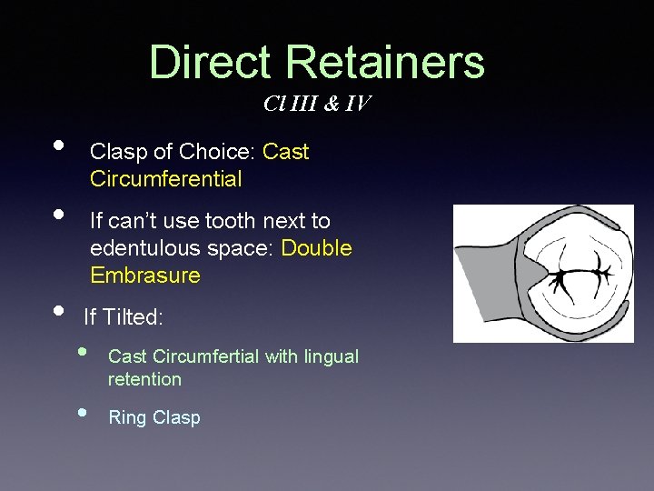 Direct Retainers Cl III & IV • Clasp of Choice: Cast Circumferential • •