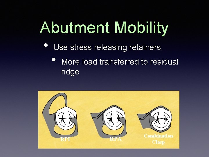 Abutment Mobility • Use stress releasing retainers • More load transferred to residual ridge Abutment Mobility • Use stress releasing retainers • More load transferred to residual ridge