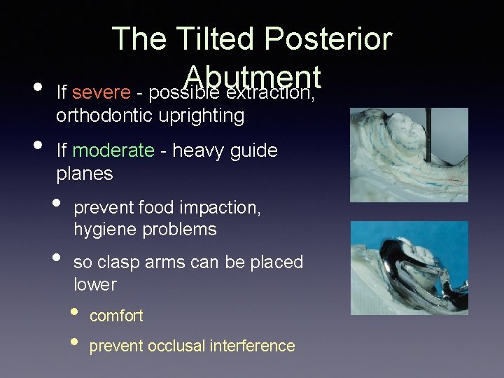 The Tilted Posterior Abutment • If severe - possible extraction, • orthodontic uprighting If The Tilted Posterior Abutment • If severe - possible extraction, • orthodontic uprighting If