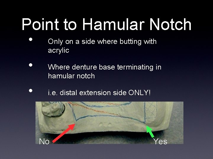 Point to Hamular Notch • • • Only on a side where butting with