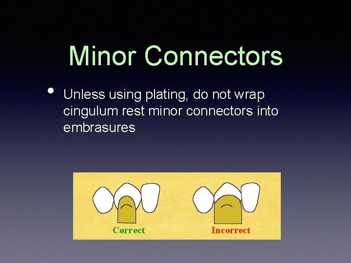 Minor Connectors • Unless using plating, do not wrap cingulum rest minor connectors into