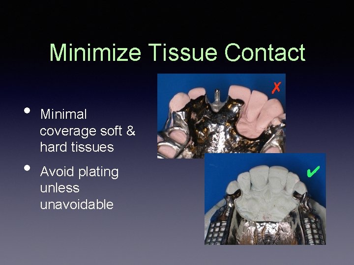 Minimize Tissue Contact ✗ • • Minimal coverage soft & hard tissues Avoid plating