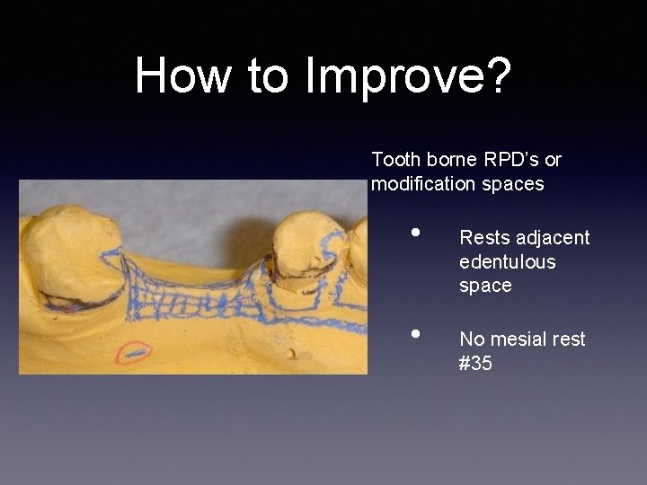 How to Improve? Tooth borne RPD’s or modification spaces • • Rests adjacent edentulous
