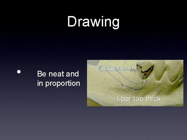 Drawing • Be neat and in proportion I-bar too thick 