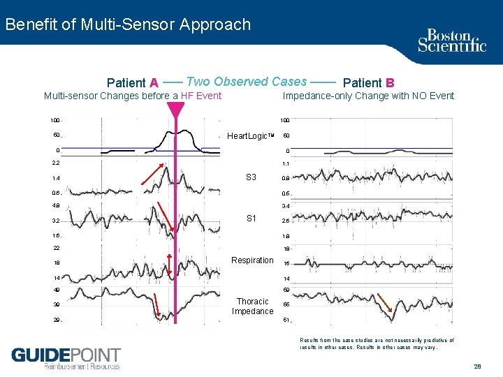 Benefit of Multi Sensor Approach Patient A Two Observed Cases Multi sensor Changes before