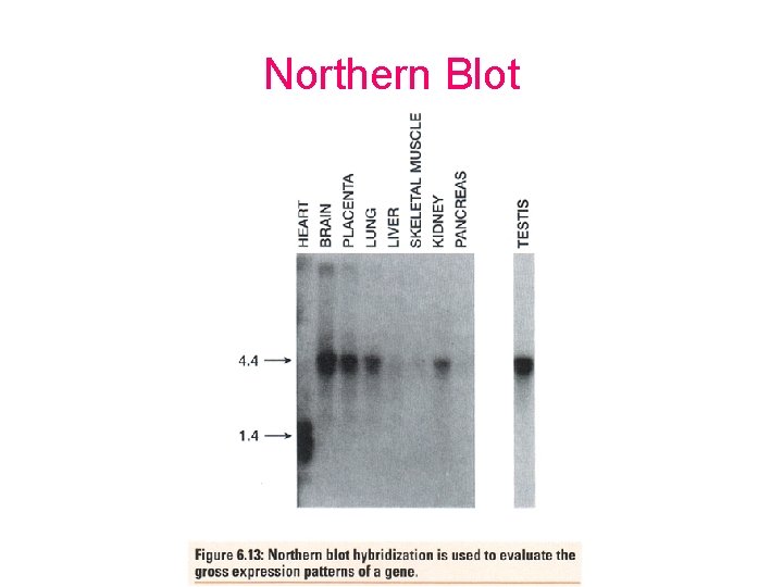 Northern Blot 