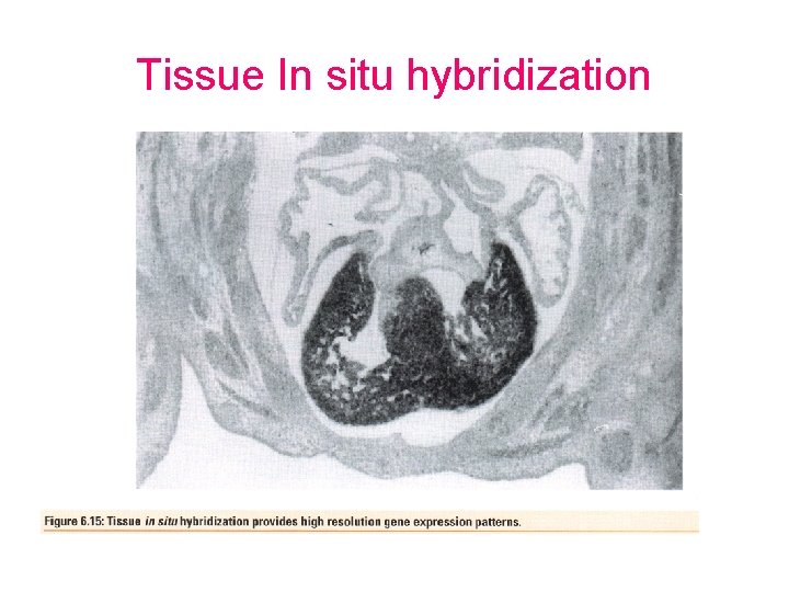Tissue In situ hybridization 