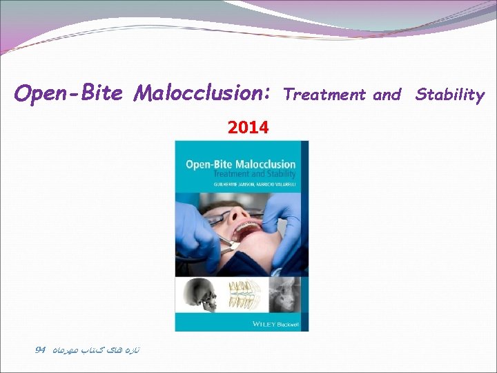 Open-Bite Malocclusion: 2014 94 ﺗﺎﺯﻩ ﻫﺎی کﺘﺎﺏ ﻣﻬﺮﻣﺎﻩ Treatment and Stability 