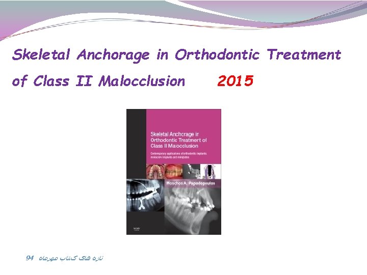 Skeletal Anchorage in Orthodontic Treatment of Class II Malocclusion 94 ﺗﺎﺯﻩ ﻫﺎی کﺘﺎﺏ ﻣﻬﺮﻣﺎﻩ