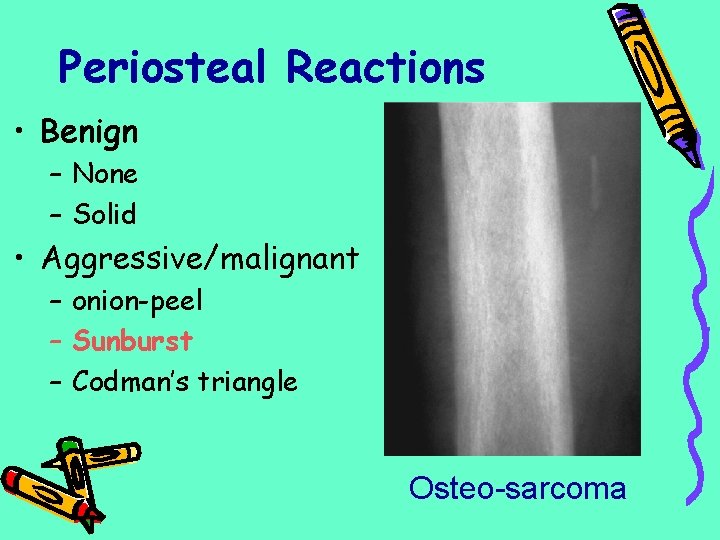 Periosteal Reactions • Benign – None – Solid • Aggressive/malignant – onion-peel – Sunburst