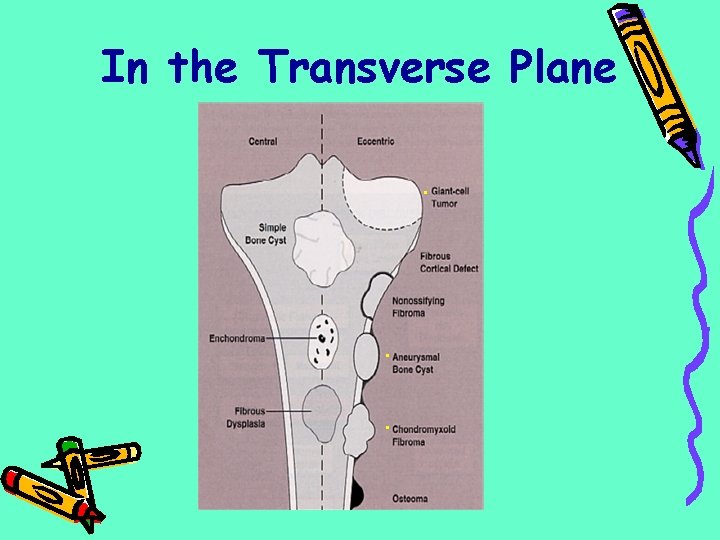 In the Transverse Plane. . . 