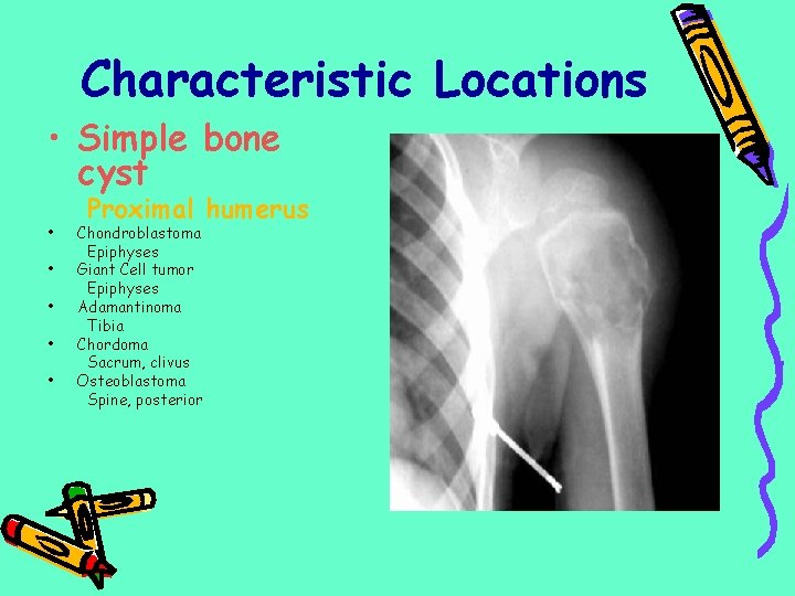 Characteristic Locations • Simple bone cyst • • • Proximal humerus Chondroblastoma Epiphyses Giant