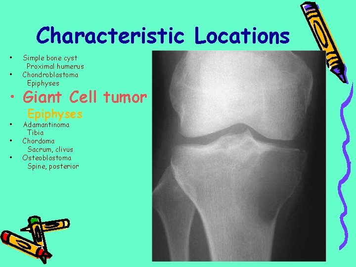 Characteristic Locations • • Simple bone cyst Proximal humerus Chondroblastoma Epiphyses • Giant Cell