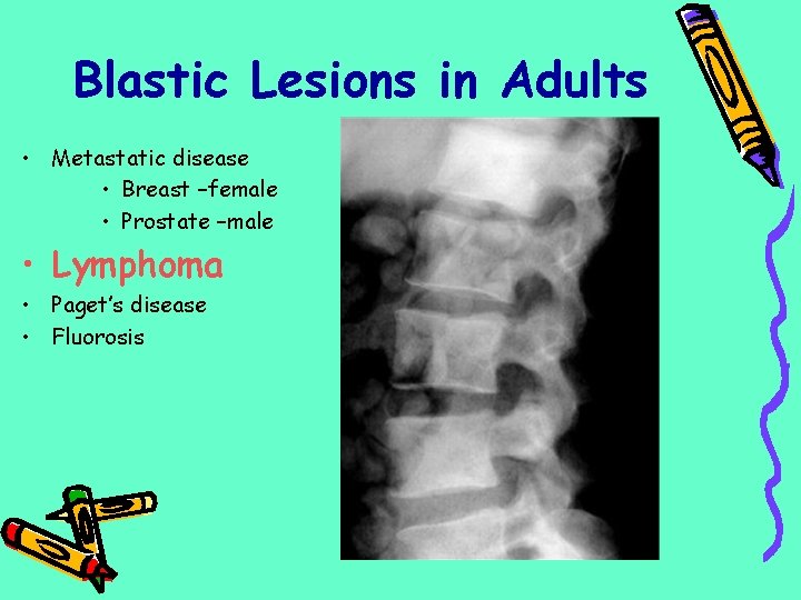 Blastic Lesions in Adults • Metastatic disease • Breast –female • Prostate –male •