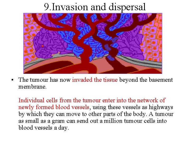 9. Invasion and dispersal • The tumour has now invaded the tissue beyond the