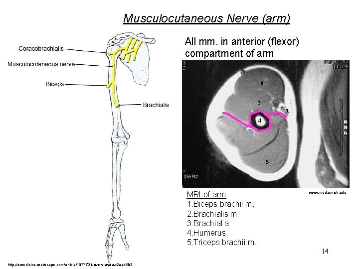 Musculocutaneous Nerve (arm) All mm. in anterior (flexor) compartment of arm MRI of arm