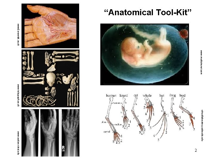 “Anatomical Tool-Kit” www 2. warwick. ac. uk www. medicinenet. com www. telegraph. co. uk