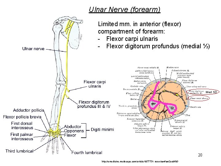 Ulnar Nerve (forearm) Limited mm. in anterior (flexor) compartment of forearm: - Flexor carpi