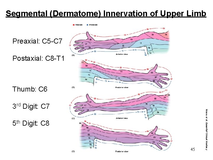 Segmental (Dermatome) Innervation of Upper Limb Preaxial: C 5 -C 7 Postaxial: C 8