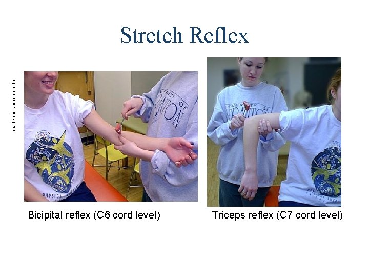 academic. scranton. edu Stretch Reflex Bicipital reflex (C 6 cord level) Triceps reflex (C