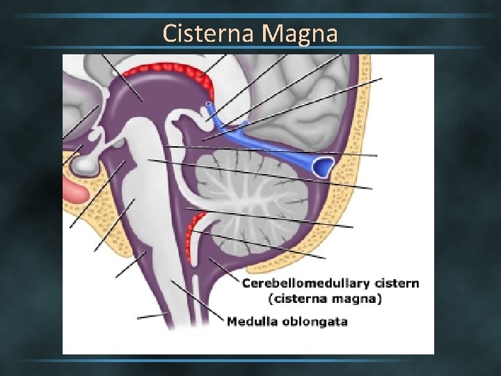 Cisterna Magna 