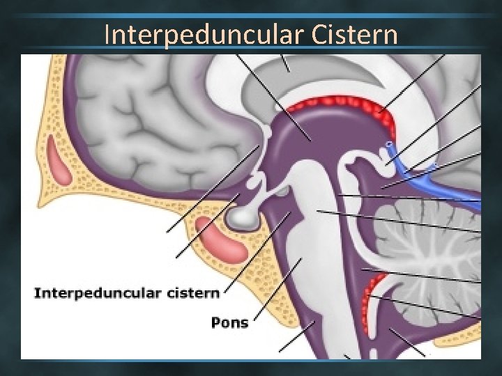 Interpeduncular Cistern 