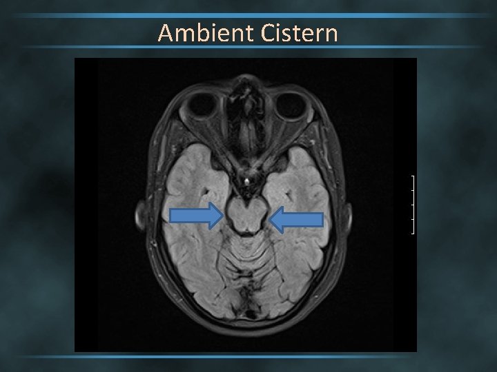 Ambient Cistern 