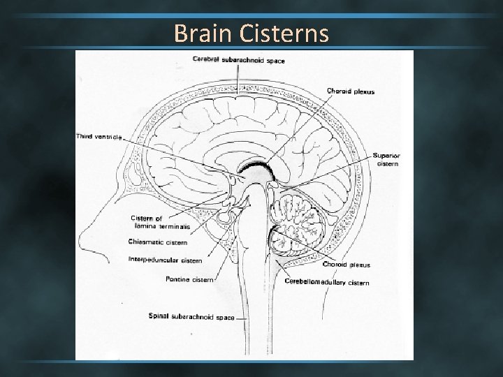 Brain Cisterns 