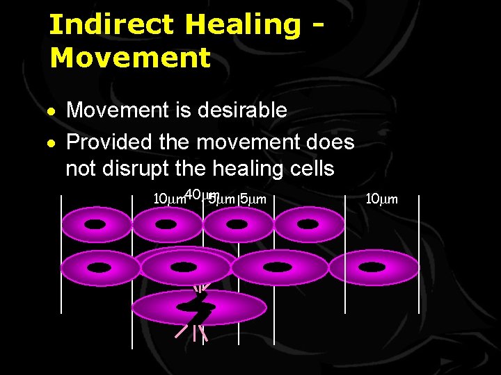 Indirect Healing Movement · Movement is desirable · Provided the movement does not disrupt