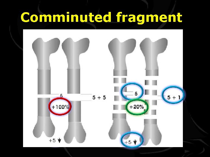 Comminuted fragment 