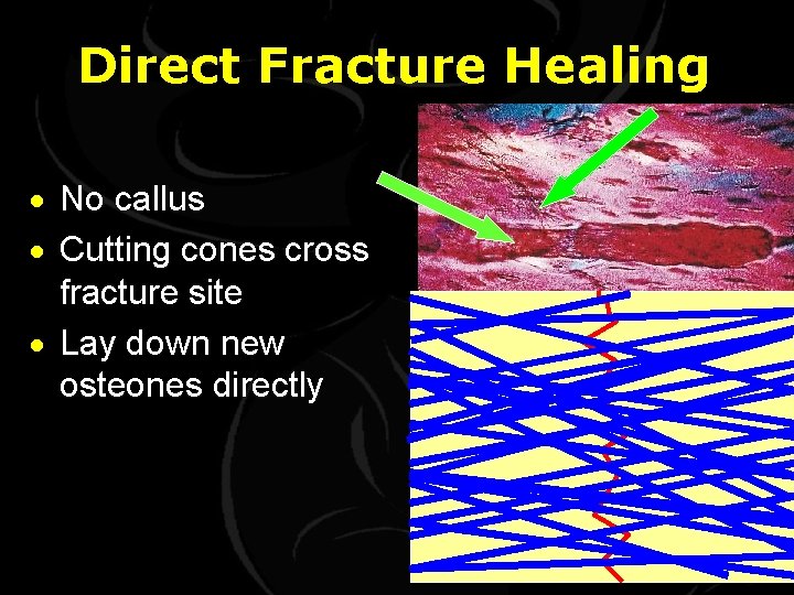 Direct Fracture Healing · No callus · Cutting cones cross fracture site · Lay
