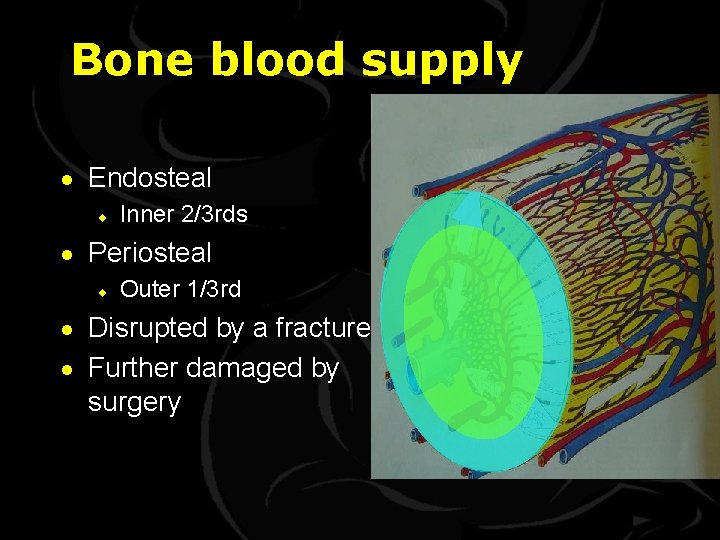 Bone blood supply · Endosteal ¨ Inner 2/3 rds · Periosteal ¨ Outer 1/3