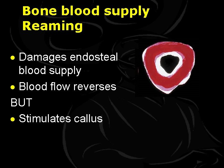 Bone blood supply Reaming · Damages endosteal blood supply · Blood flow reverses BUT