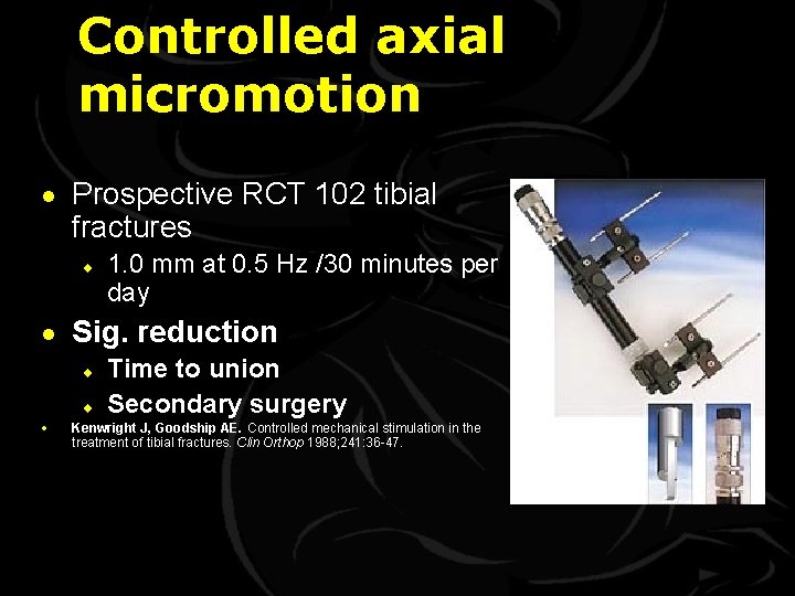 Controlled axial micromotion · Prospective RCT 102 tibial fractures ¨ 1. 0 mm at