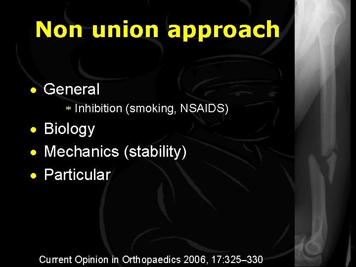 Non union approach · General * Inhibition (smoking, NSAIDS) · Biology · Mechanics (stability)