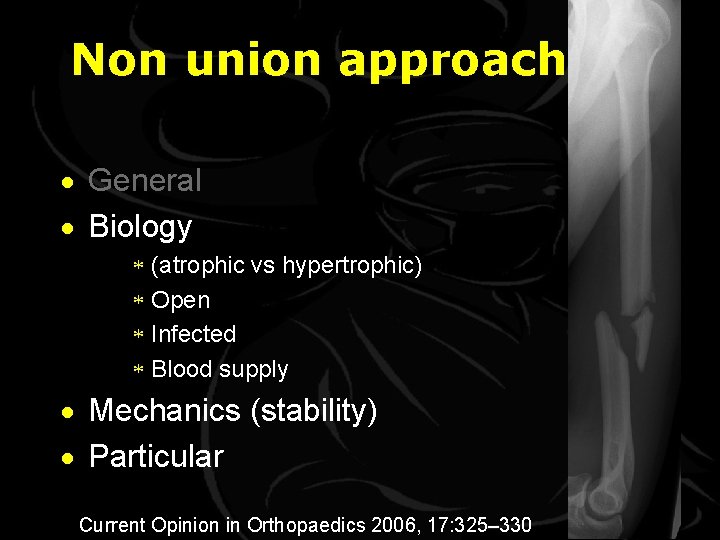 Non union approach · General · Biology * (atrophic vs hypertrophic) * Open *