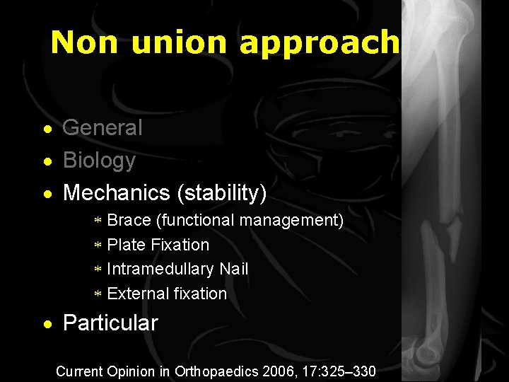 Non union approach · General · Biology · Mechanics (stability) * Brace (functional management)