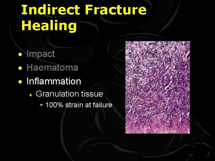 Indirect Fracture Healing · Impact · Haematoma · Inflammation ¨ Granulation tissue * 100%
