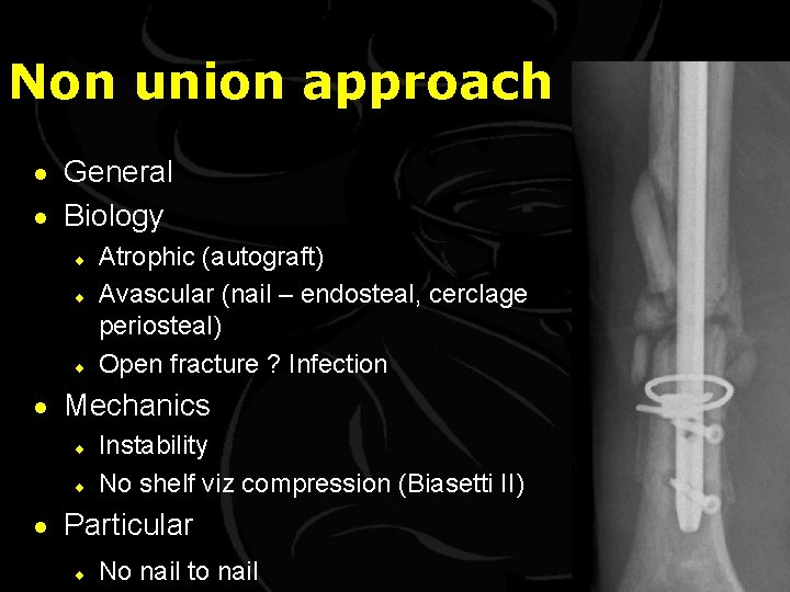 Non union approach · General · Biology ¨ ¨ ¨ Atrophic (autograft) Avascular (nail