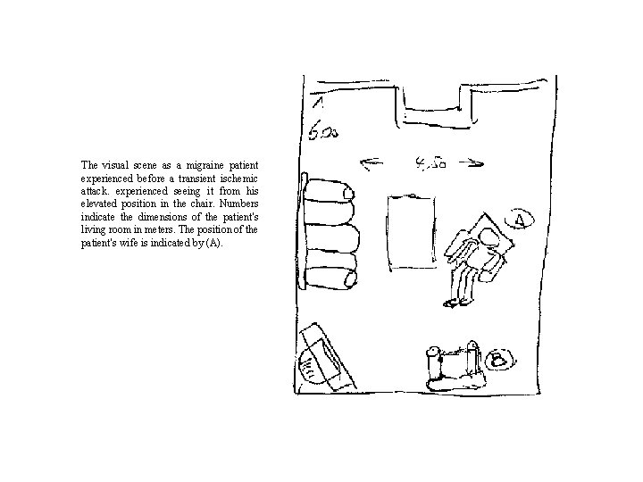 The visual scene as a migraine patient experienced before a transient ischemic attack. experienced