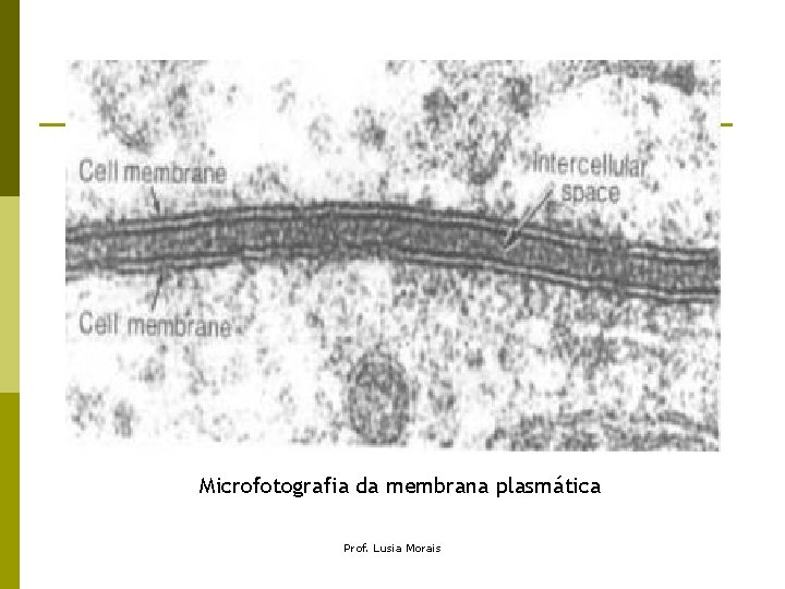 Microfotografia da membrana plasmática Prof. Lusia Morais 