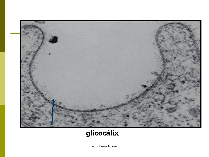 glicocálix Prof. Lusia Morais glicocálix Prof. Lusia Morais