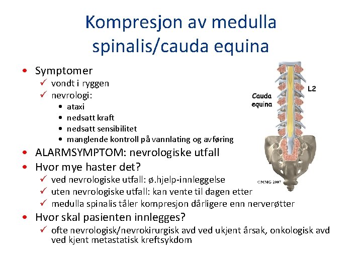 Kompresjon av medulla spinalis/cauda equina • Symptomer ü vondt i ryggen ü nevrologi: •