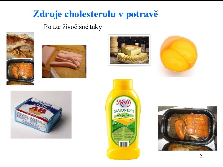 Zdroje cholesterolu v potravě Pouze živočišné tuky 21 