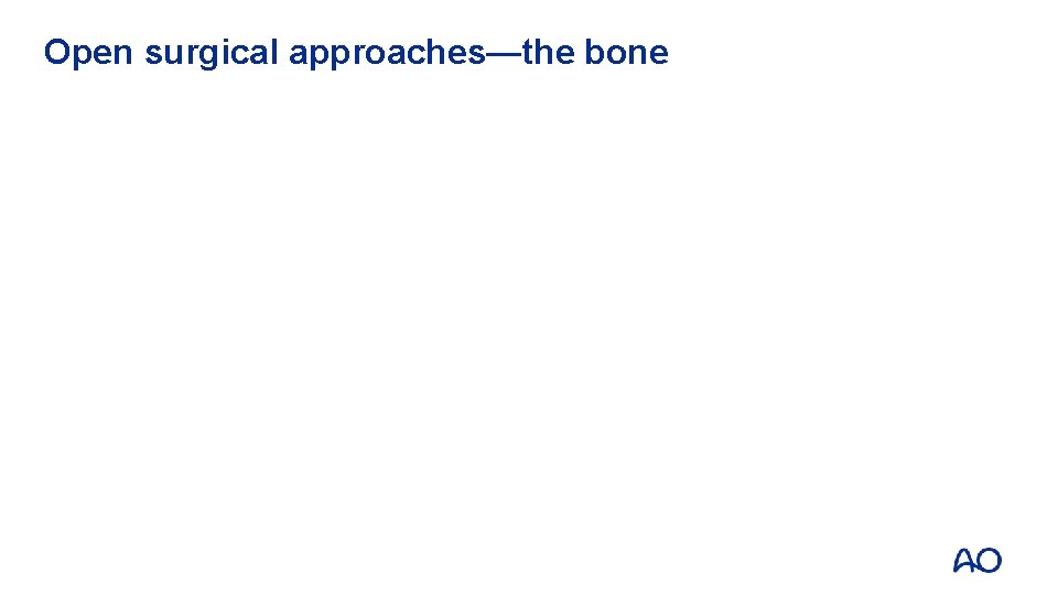 Open surgical approaches—the bone 